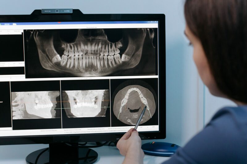 Forensic Odontology